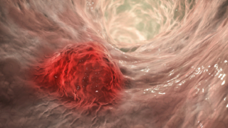 تغيرات في الجسم قد تظهر قبل 8 سنوات من تشخيص مرض مزمن